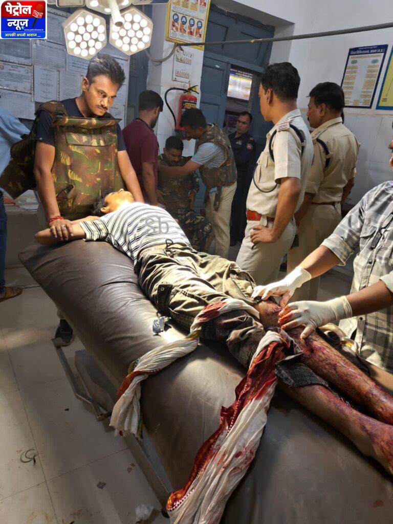 MP News:थाने में गोली चलाने वाला आदर्श पुलिस मुठभेड़ में गिरफ्तार, पैर में लगी गोली