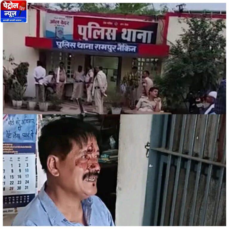 MP: नायब तहसीलदार पर जानलेवा हमला, आरोपियों की तलाश में जुटी पुलिस